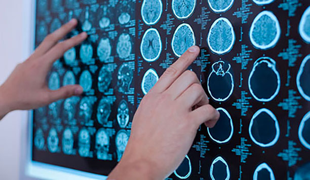 Person reading a MRI scan